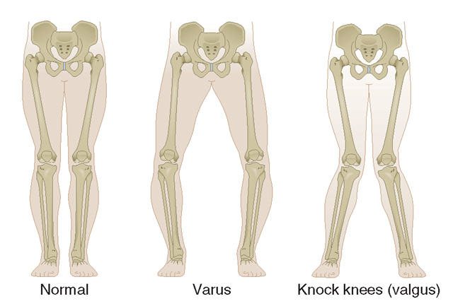 The Knee Issues Series: Human Knee